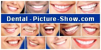 Logo for Dental-Picture-Show.com